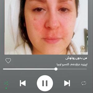 A.E.F 1 ”اپیزود دوازدهم : ” کنسرو لوبیا