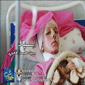 لاکتیک اسید اسید